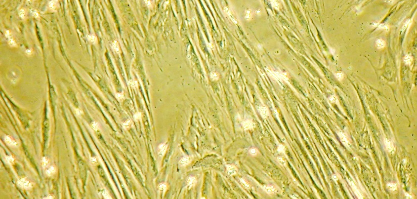 脐带间充质干细胞 (5)